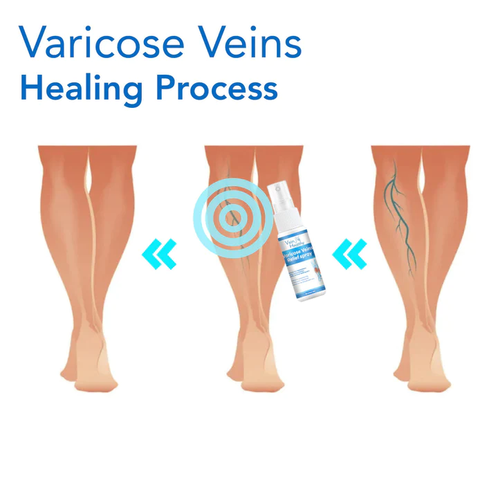 VeinHealthy Varicose Veins Spray