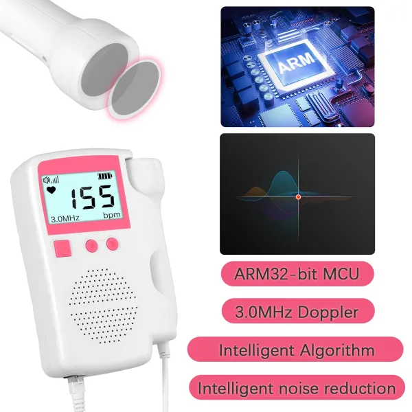 Prenatal Fetal Doppler