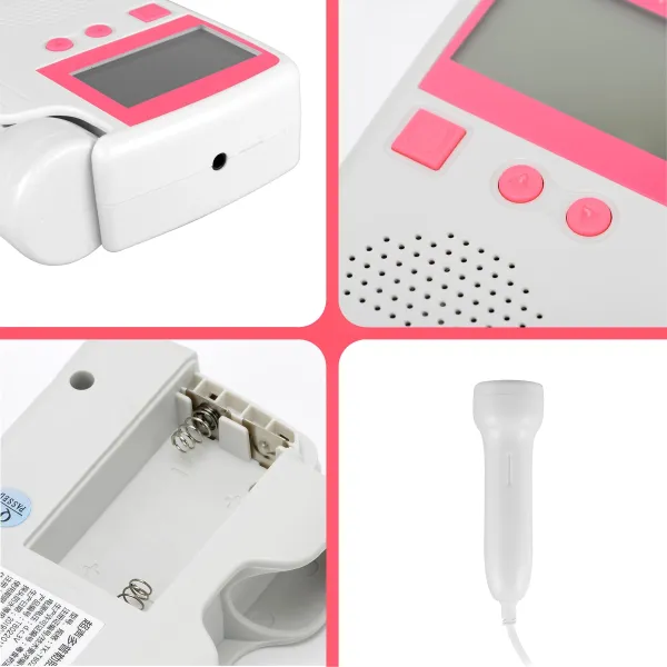 Prenatal Fetal Doppler