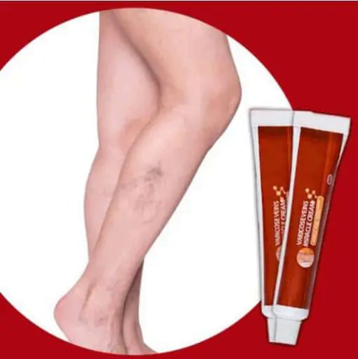 Varicose Veins Miracle Cream