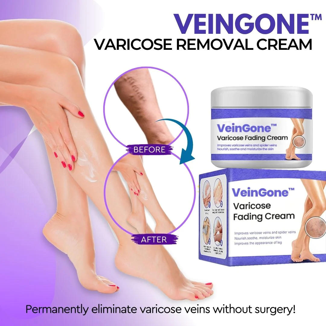 VeinGone Varicose Fading Cream