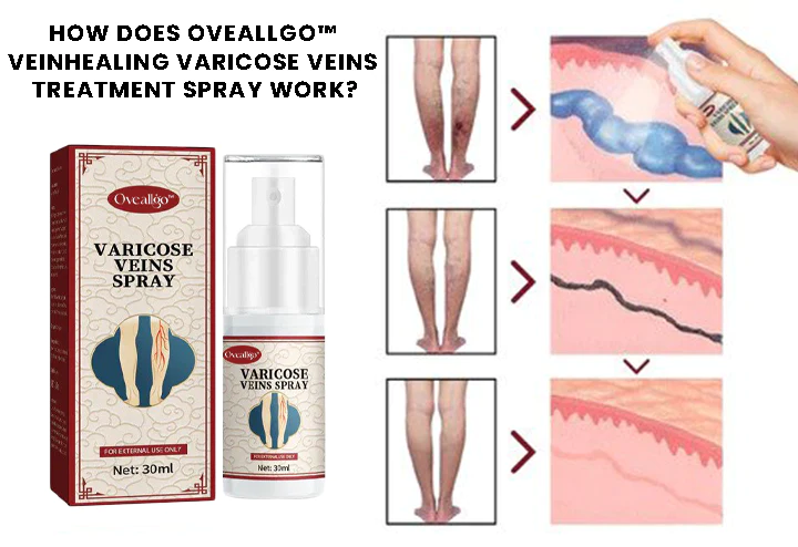 Oveallgo VeinHealing Varicose Veins Treatment Spray