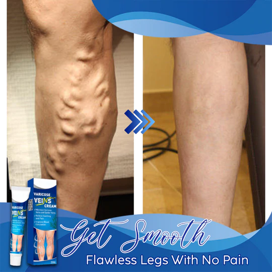 Veins Gone Smoothing Cream