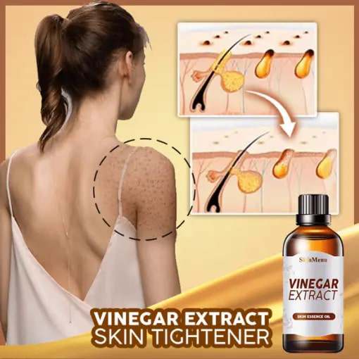 Vinegar Extract Skin Tightener