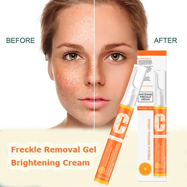 Vitamin C Freckle Dark Spot Removal Cream