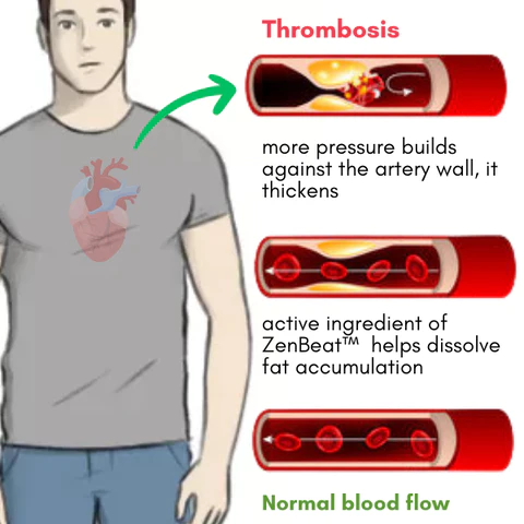 ZenBeat Blood Pressure Tea