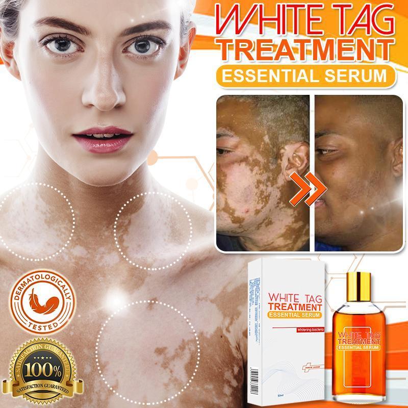 White Tag Treatment Essential Serum