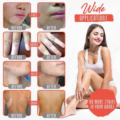 White Tag Treatment Moisturizes Body Spray