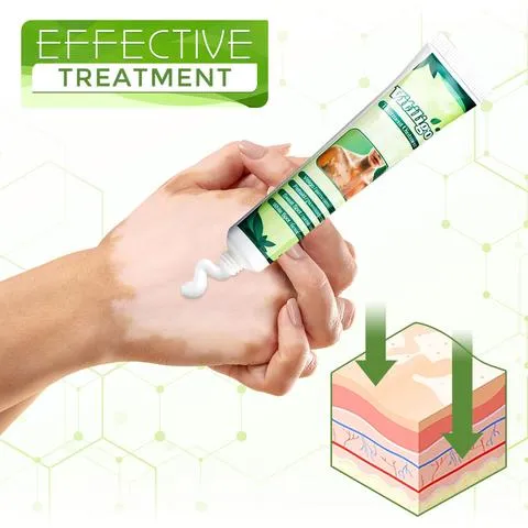 White Tag Treatment Moisturizing Cream