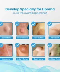 HEALumps Lipoma Treatment Ointment