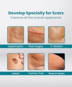 ScarOFF Advanced Scar Removal Gel