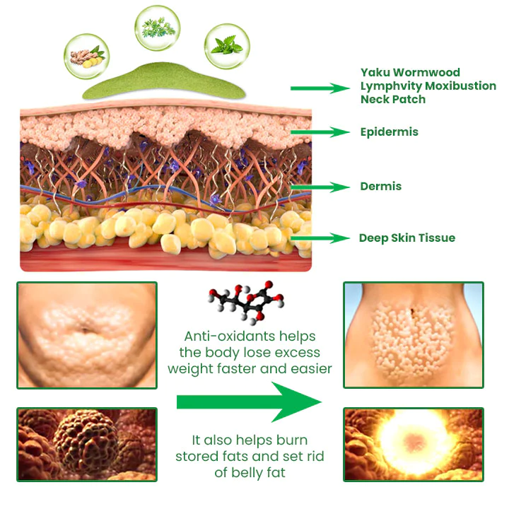 Yaku Wormwood Lymphvity Moxibustion Neck Patch