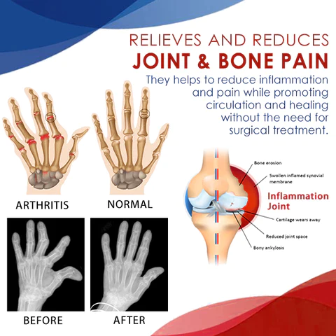 TIMNAMY Joint and Bone Therapy Roll-on liquid  Full Body can be applied-pain disappear(Limited time discount Last 30 minutes)