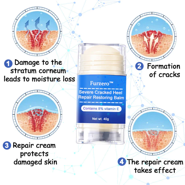 Furzero Intense Cracked Heel Repair Cream