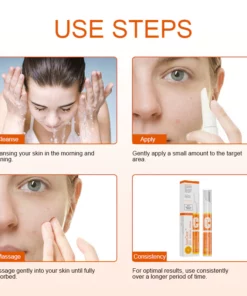 SpotClear Spot Removal Cream