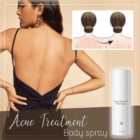 Acne Treatment Body Spray