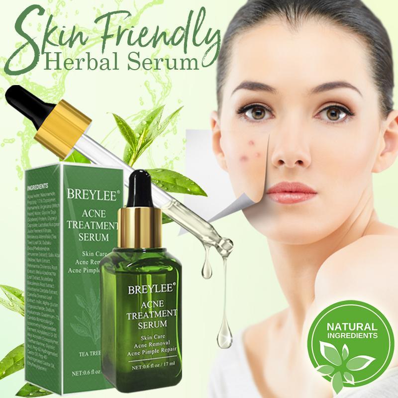 Acne Away Herbal Serum 17ml