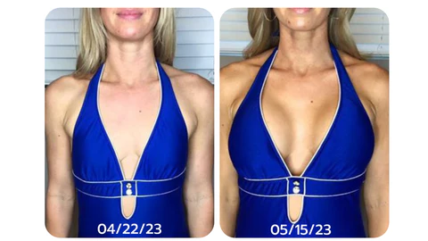 Dobshow Lymphatic Detox & Shaping-Lifting Bra