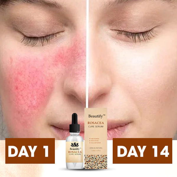 Beautify Rosacea Cure Serum