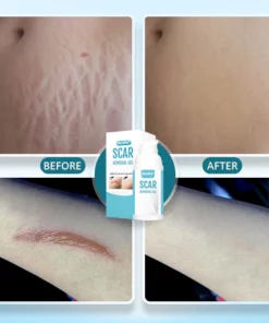 SkinPro Scar Removal Gel