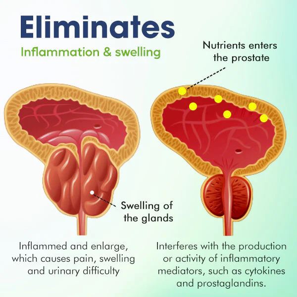 MediCare Prostate Treatment Drops