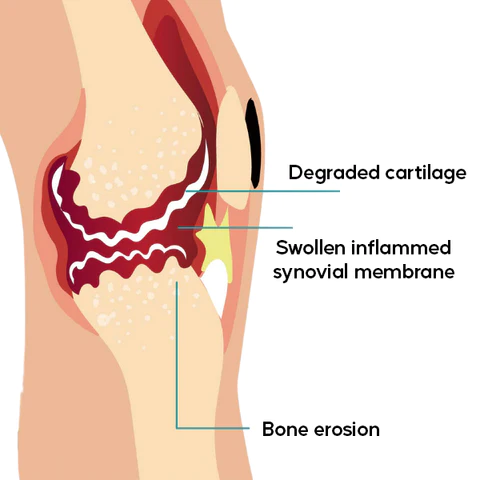 EnhanceBoost Joint & Bone Therapy Spray