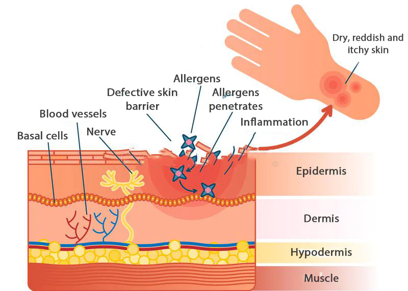 Dermax Folliculitis Clearing Spray