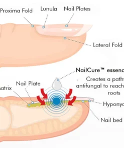 NailCure Fungi Treatment Pen