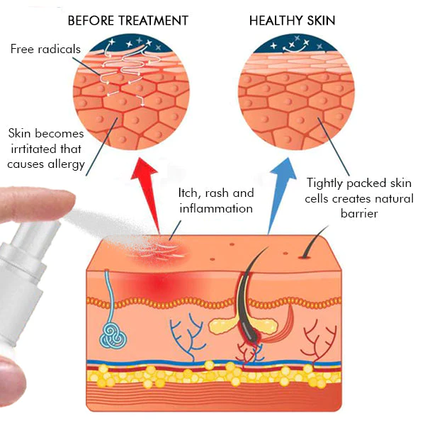 Dermax Folliculitis Clearing Spray