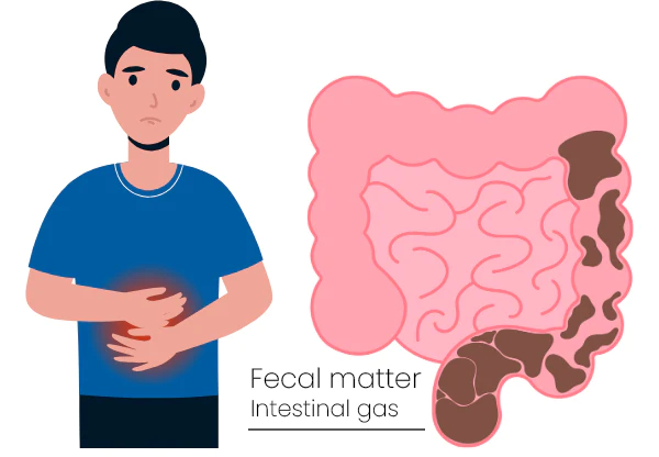 Vflux Constipation Relief Capsule