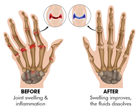 EnhanceBoost Joint & Bone Therapy Spray