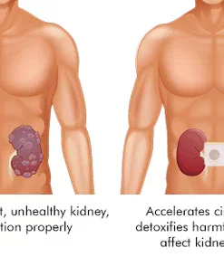 Oveallgo MedMax CURE Kidney Care Patch