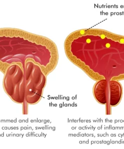 FemiPure Prostate Vitality Complex