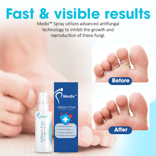 Medix Athlete's Foot & Fungus Spray