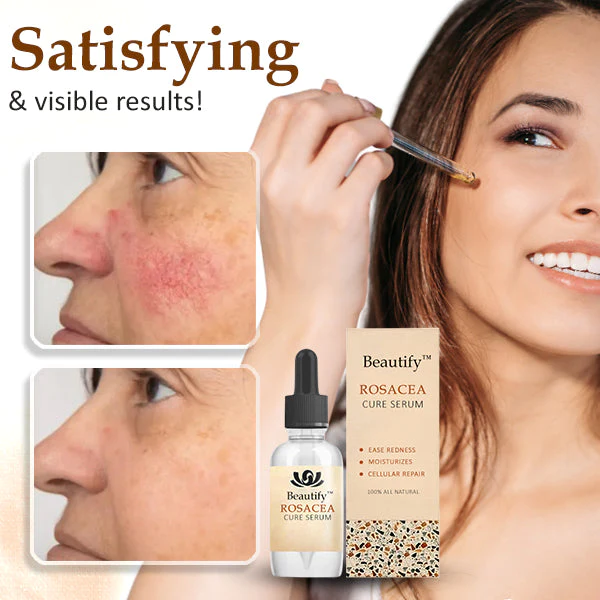 Beautify Rosacea Cure Serum