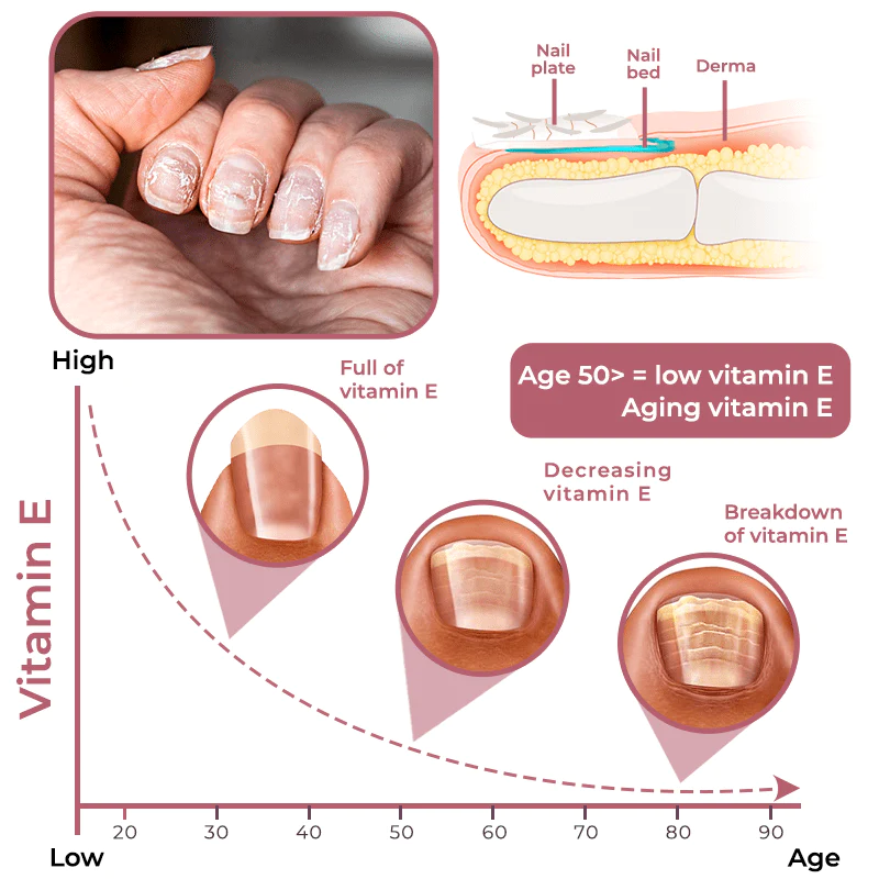 GFOUK Peeling Nail Therapy Vitamin E Serum