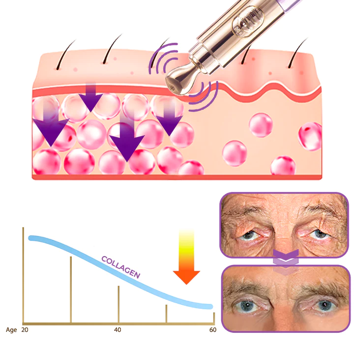 GFOUK Milk Spot Therapy Vibration Serum Pen