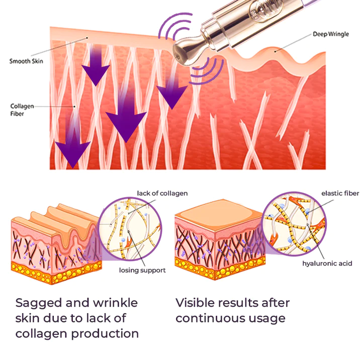 GFOUK Milk Spot Therapy Vibration Serum Pen