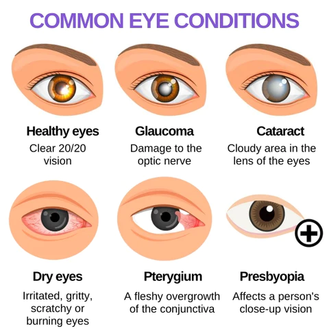 AEXZR Ophthalmic Solution