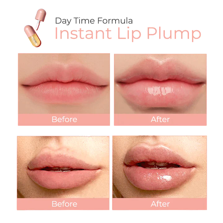 DEROL Lip Plumper Kit