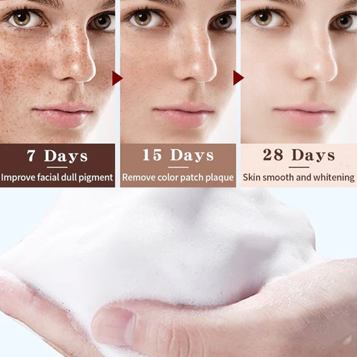 SOUTHERN RI Whitening Freckle Removal Cleanser