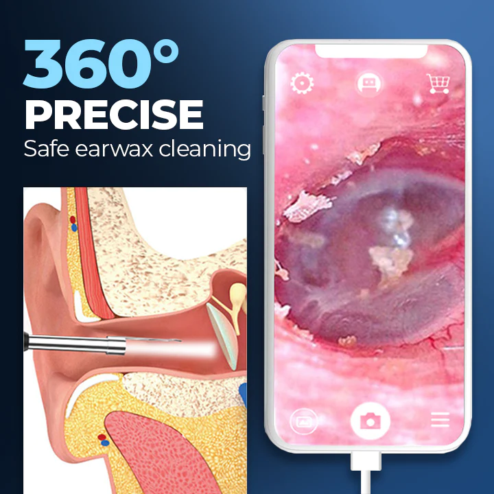 ViewScan Visible Earwax Cleaning Otoscope