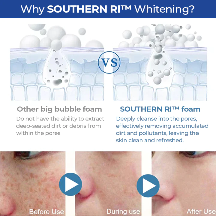 SOUTHERN RI Whitening Freckle Removal Cleanser