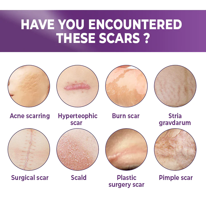 BIOCLEAR Silicone Scar Reduction Sheets