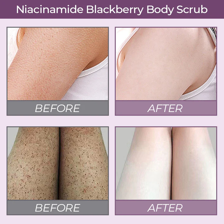 FreshVital Niacinamide Blackberry Body Scrub