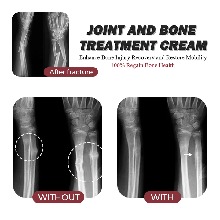 MEDix Joint & Bone Therapy Cream