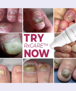 RxCARE Ginger Nail Treatment Essence