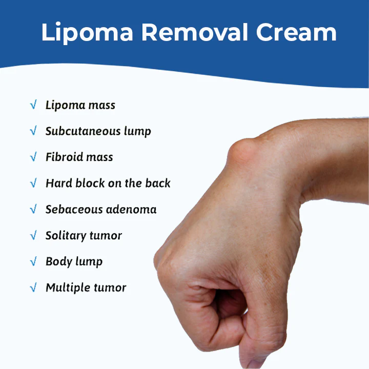 MEDix Lipoma Removal Cream