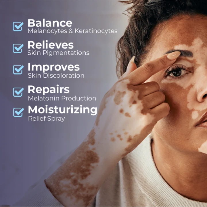 MEDix Vitiligo Relief Spray