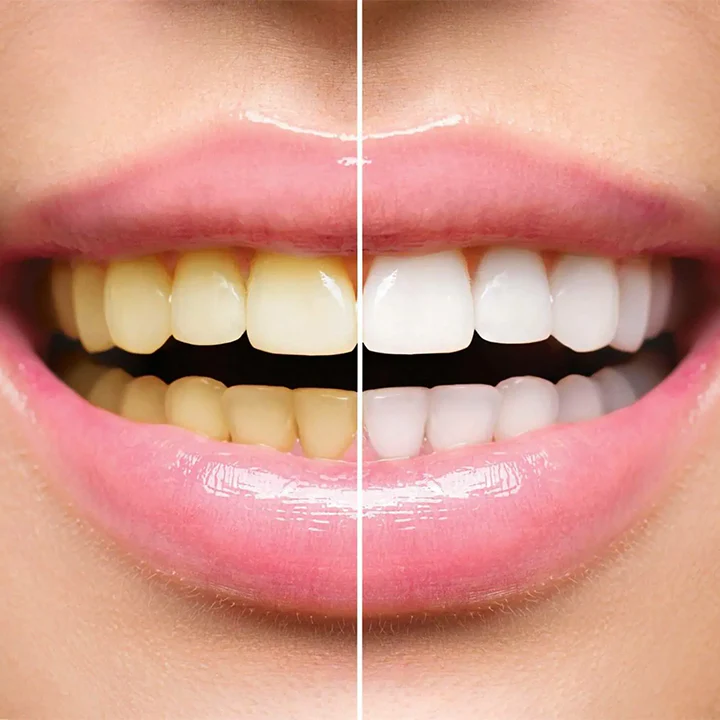 LANTHOME Teeth Whitening Mousse